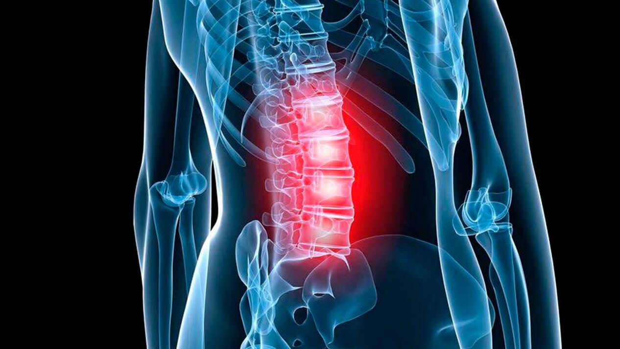 jostas daļas osteohondrozes simptomi