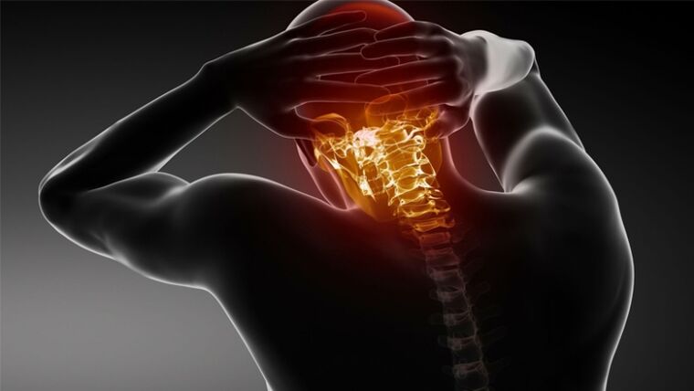 sāpes pakausī ar dzemdes kakla osteohondrozi