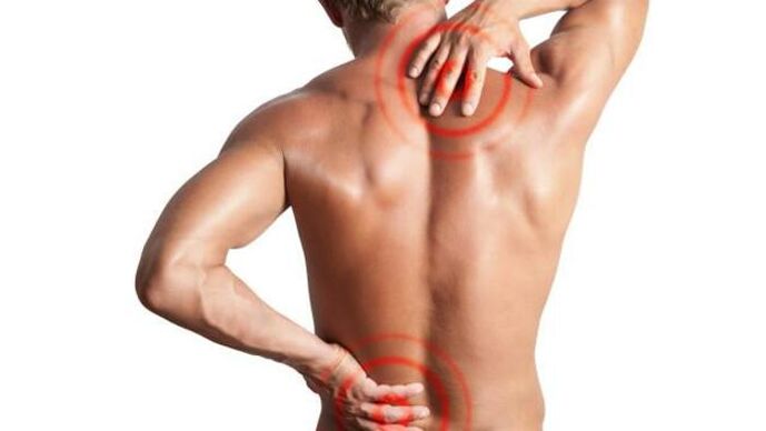 sāpes osteohondrozes dēļ